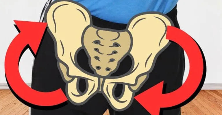 How to Fix Low Back and Hip Pain Caused by an Elevated Pelvis